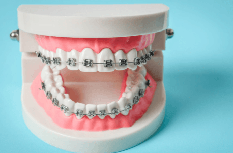 Why Personalised Orthodontic Plans Deliver Better Results